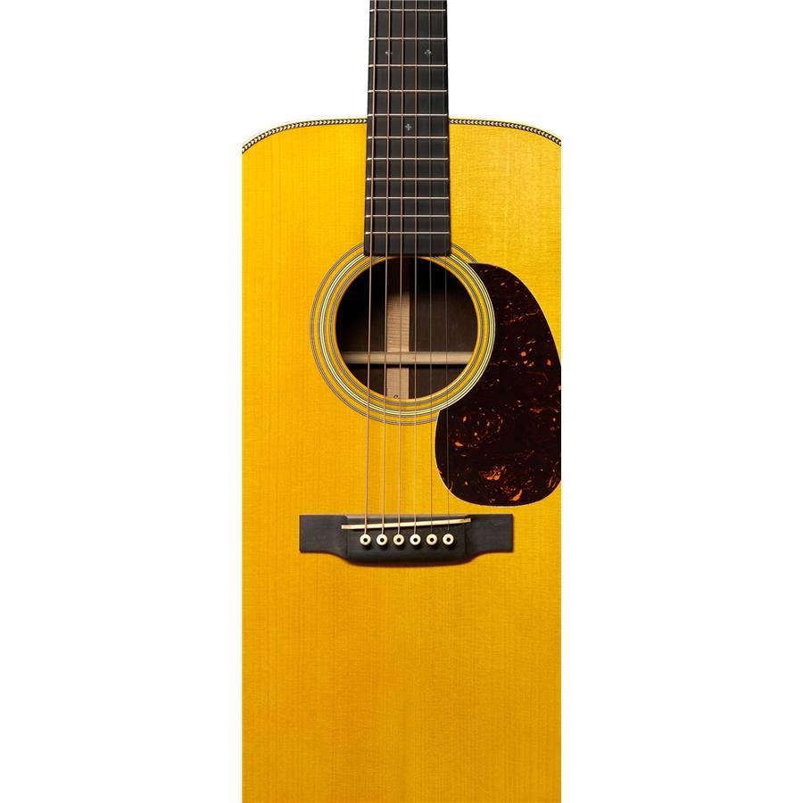 33-martin-co-10ce-03mr-d-28-adirondack-madagascar-stage-1-aged-06601401_3